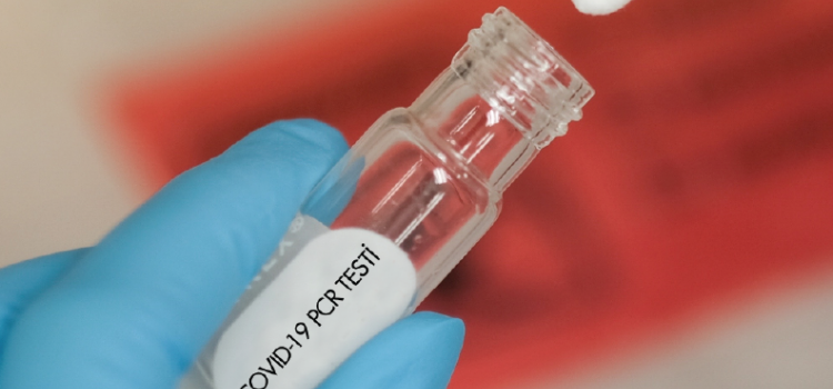 COVID-19 PCR Testi
